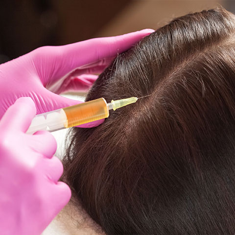Fuller, Thicker Hair with PRP