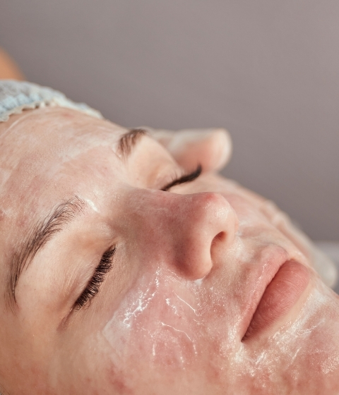 Acne Facial Special Promo