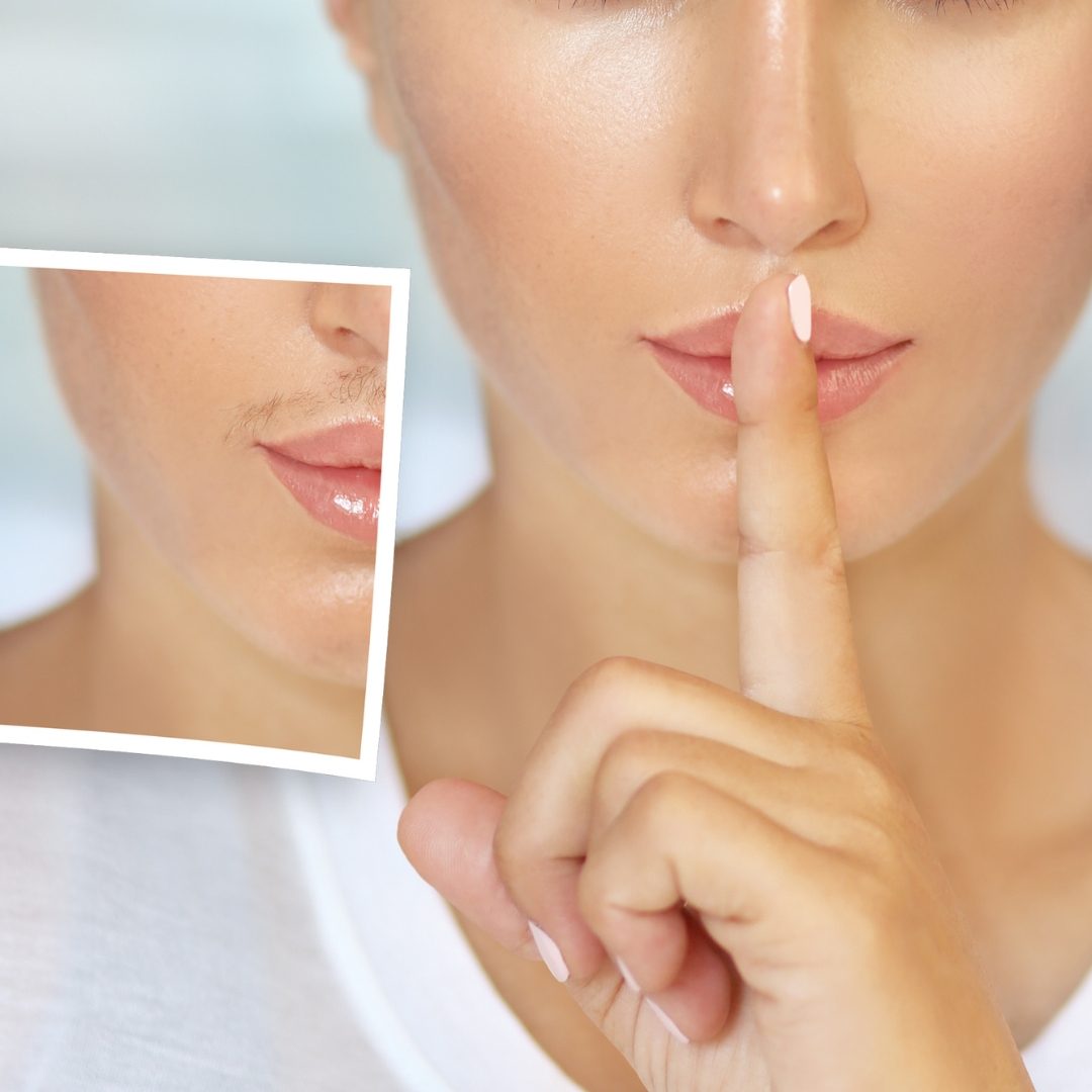Upper Lip Hair Removal in St. Paul, MN / Roseville MN