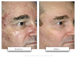 aser Hair Removal & Skin Treatments